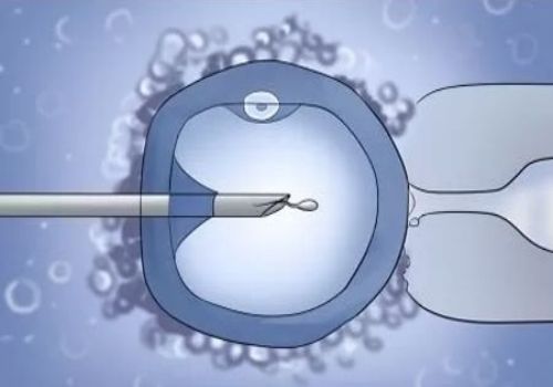 为什么满34周医生不推荐保胎？原来和这些因素密切相关